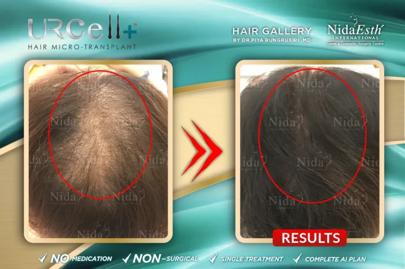 Urcell-Hair-20-800x533