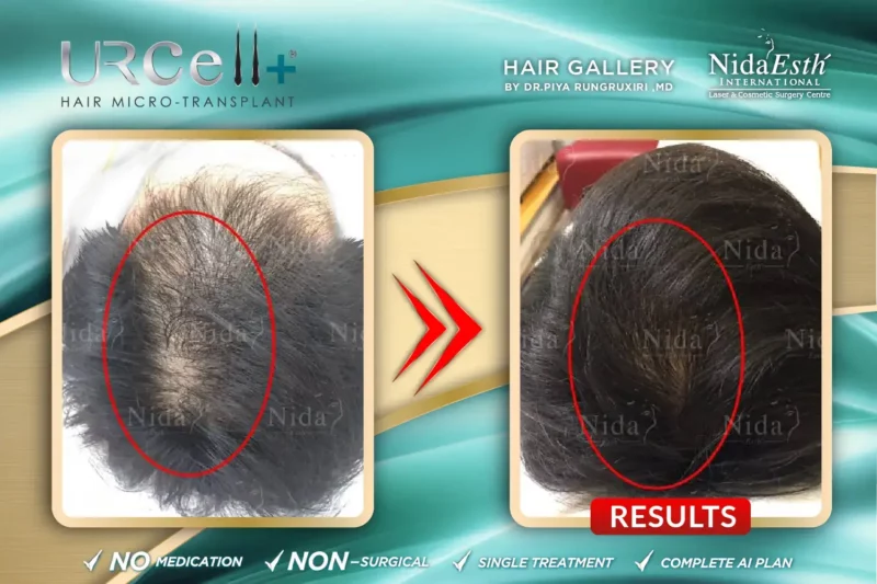 Urcell-Hair-21-800x533