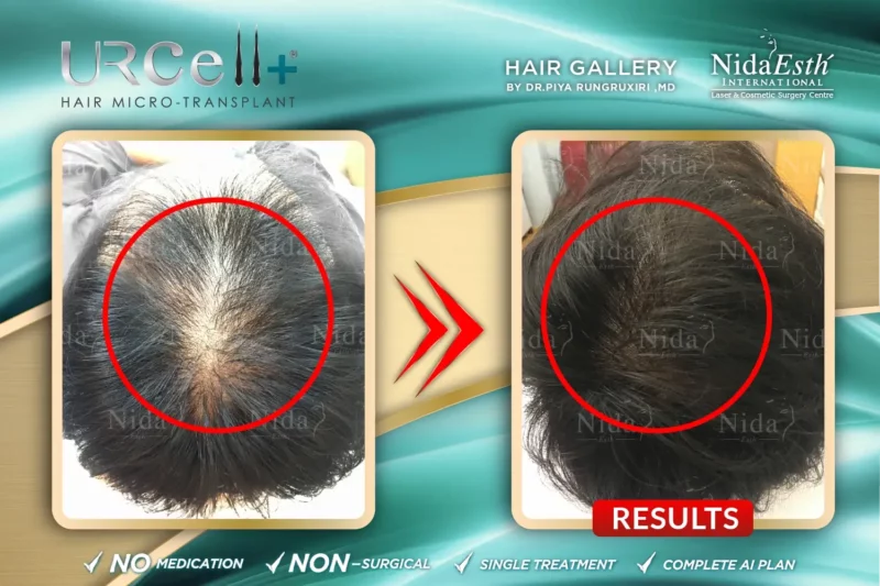 Urcell-Hair-22-800x533