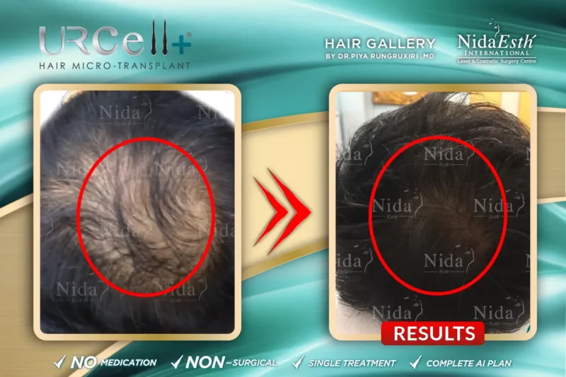 Urcell-Hair-23-800x533